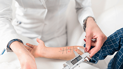 알레르기 정밀 검사