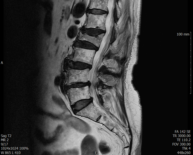 척추 및 관절 질환