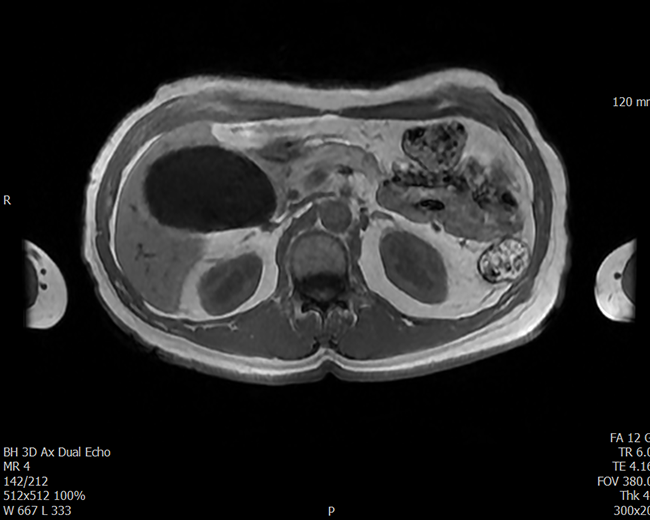 복부 및 골반 질환