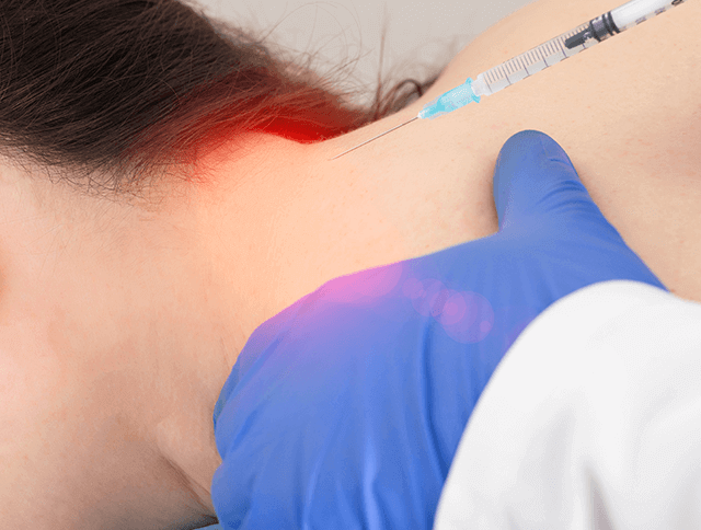 후두 신경 차단술