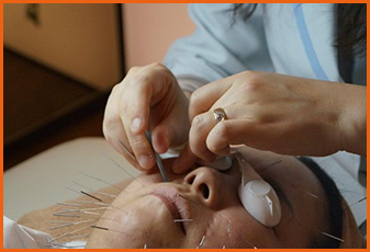 안면근육침 프로그램 소개