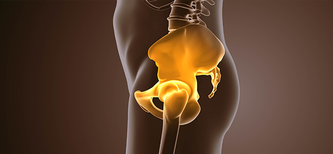 고관절 뼈의 비정상적인 모양