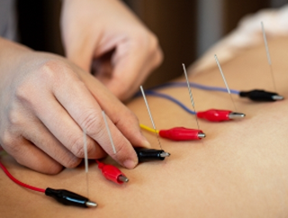 전침 치료