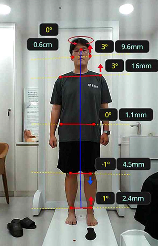 근골격 불균형 검사