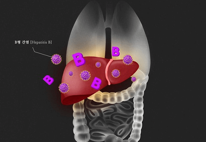 B형간염