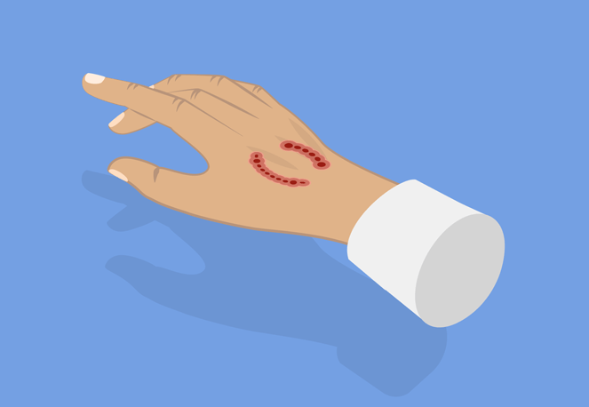 파상풍, 디프테리아, 백일해